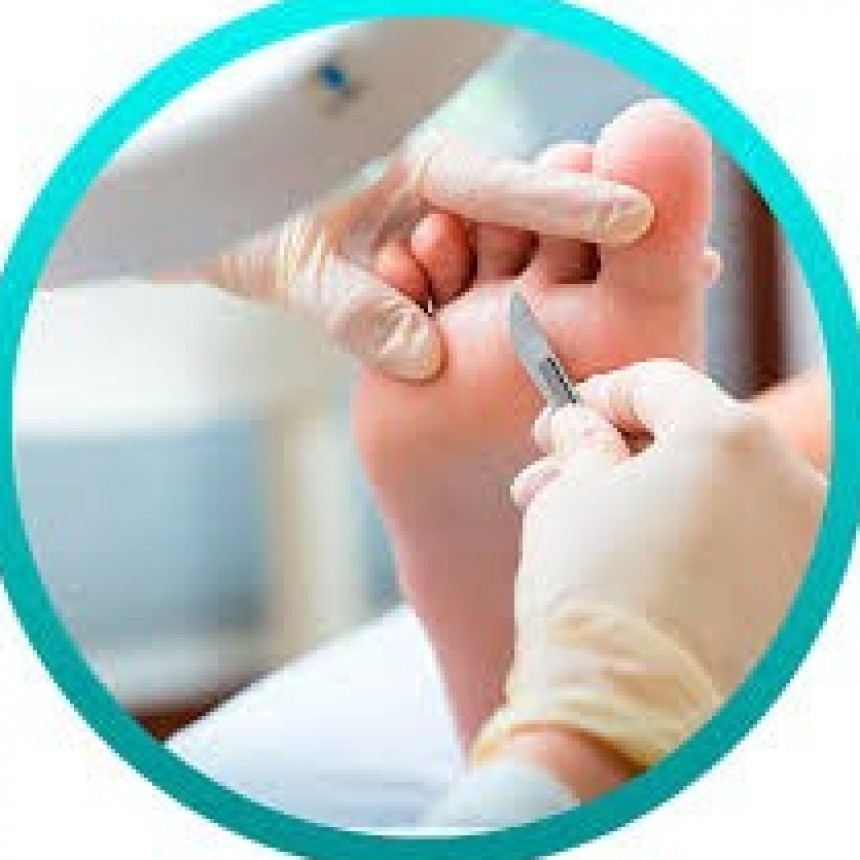 SERVICIO DE PODOLOGÍA GRATUITO EN EL BARRIO LAPRIDA