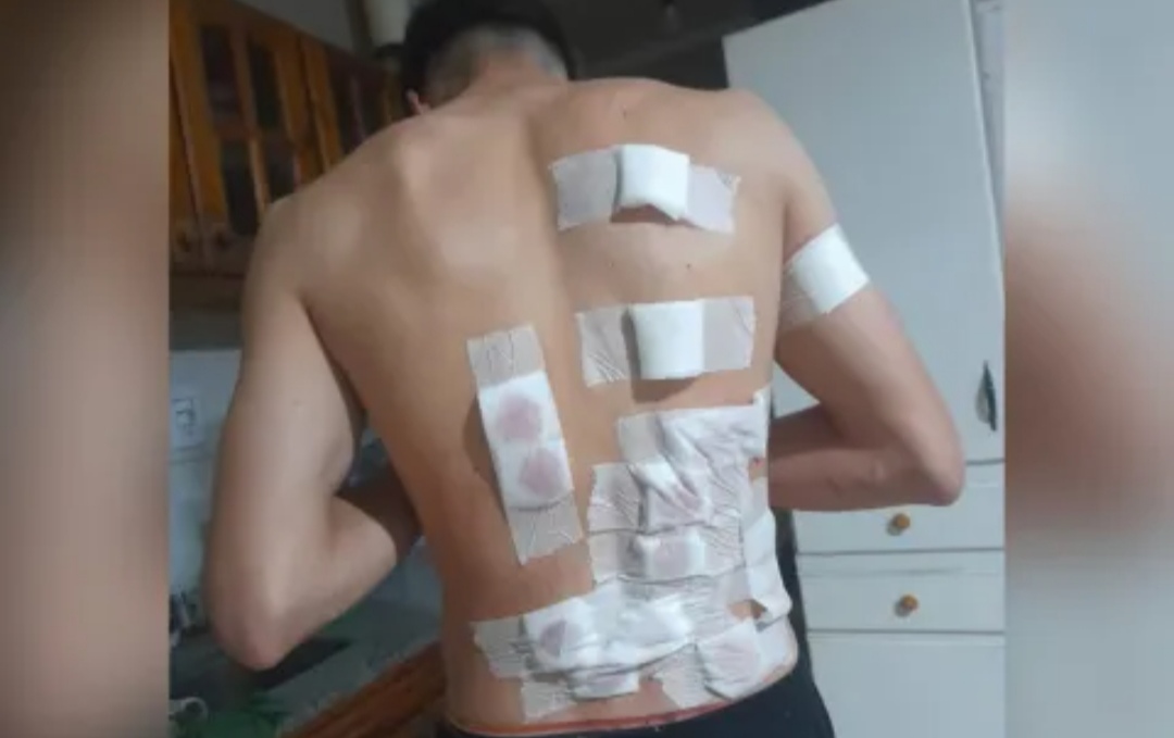 Un joven denunció que policías motorizados lo atacaron con balas de goma