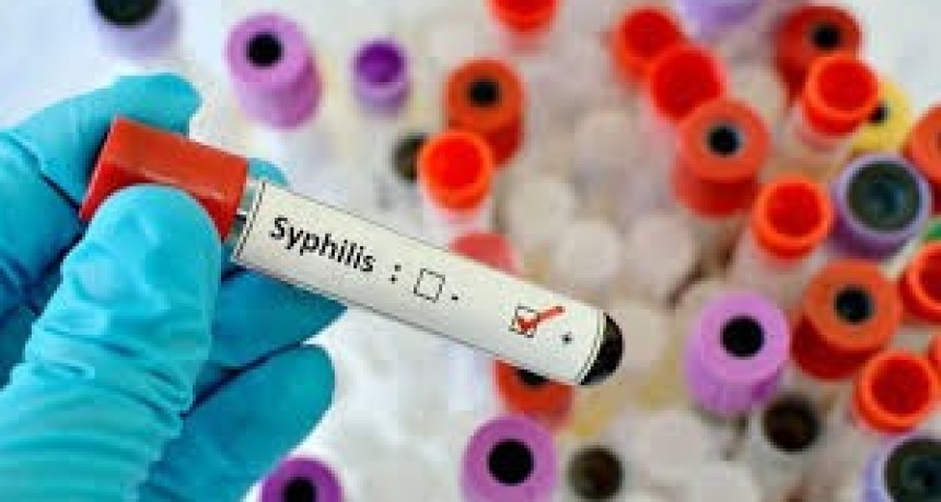 Alarma Sanitaria en San Juan: Preocupante Aumento de Sífilis y VIH con Diagnósticos Tardíos
